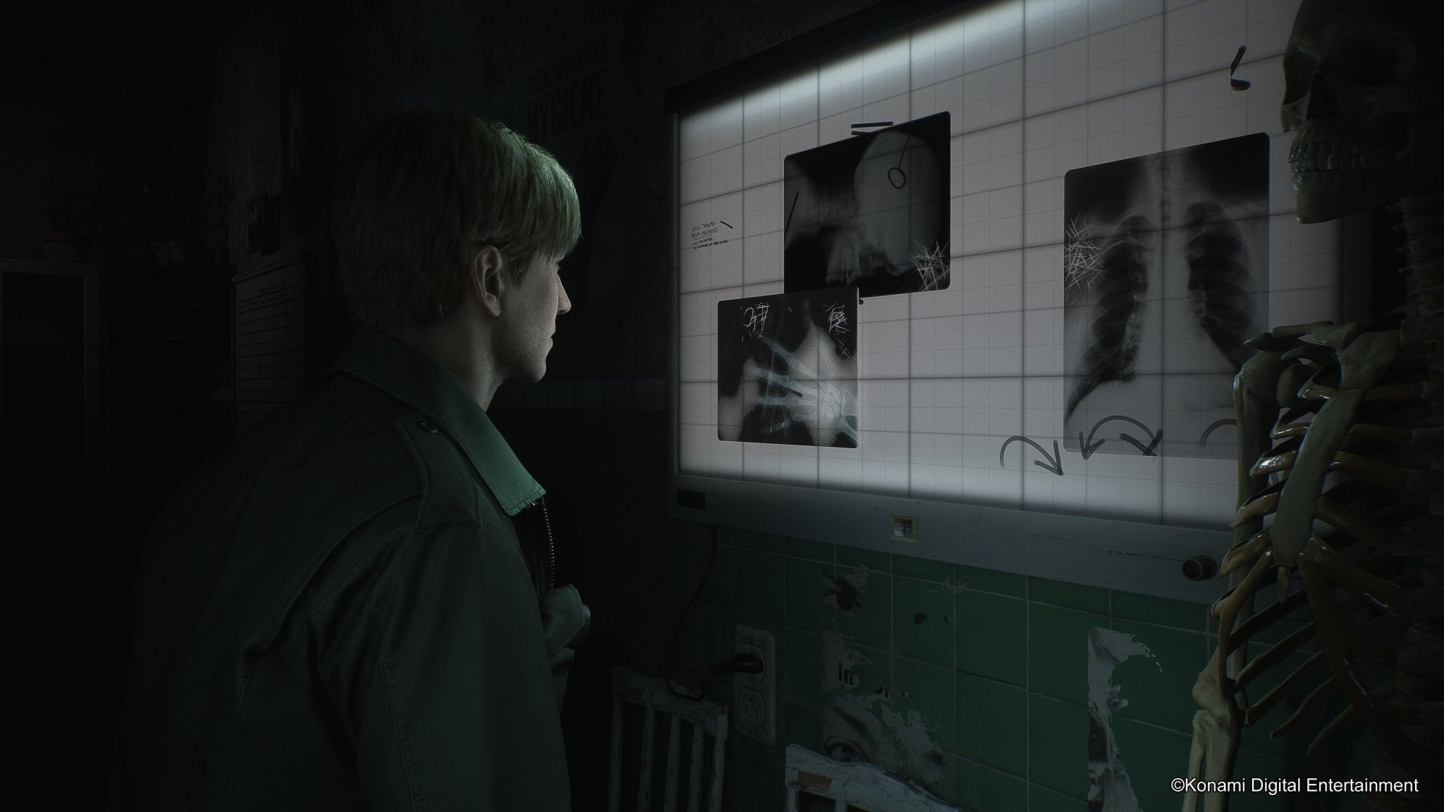 Silent Hill 2 PS5 - Jeux Vidéo Physique - Konami - Shop Just for Games